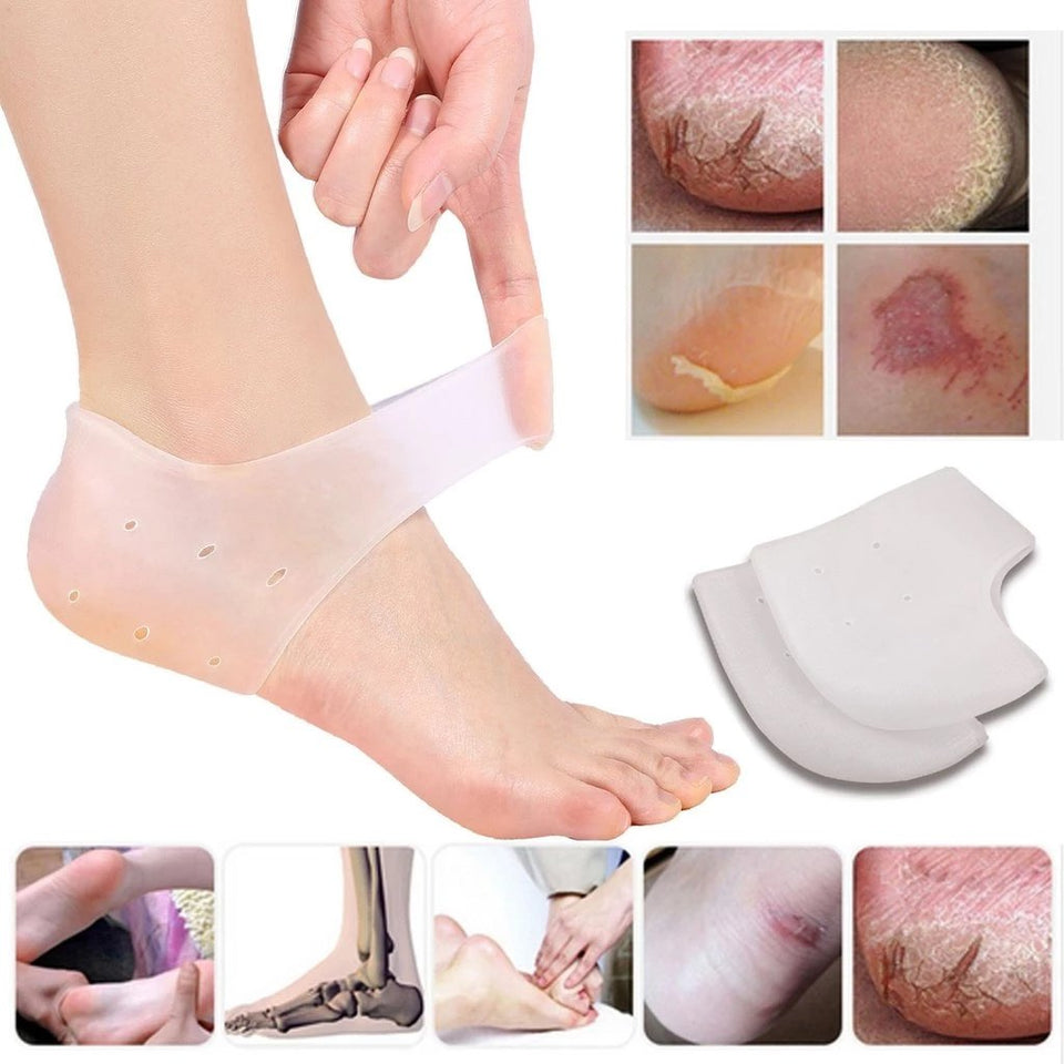 Amazon.com: Pumice Stone for Feet & Moisturizing Heel Sleeves - Natural  Lava Foot Stone Callus Removing Set - Cracked Heel Treatment - Foot Care Kit  for Dry Cracked Feet Body Hands :